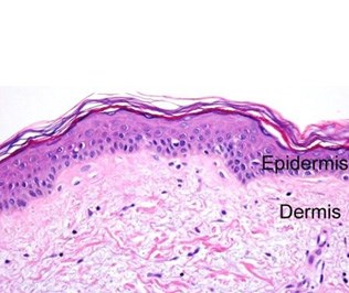 This is a section of lightly keratinized skin. Keratinization protects the underlying epidermis. This section is most likely taken from an area of the body that needs minimal protection, such as the shoulders, arms or legs.