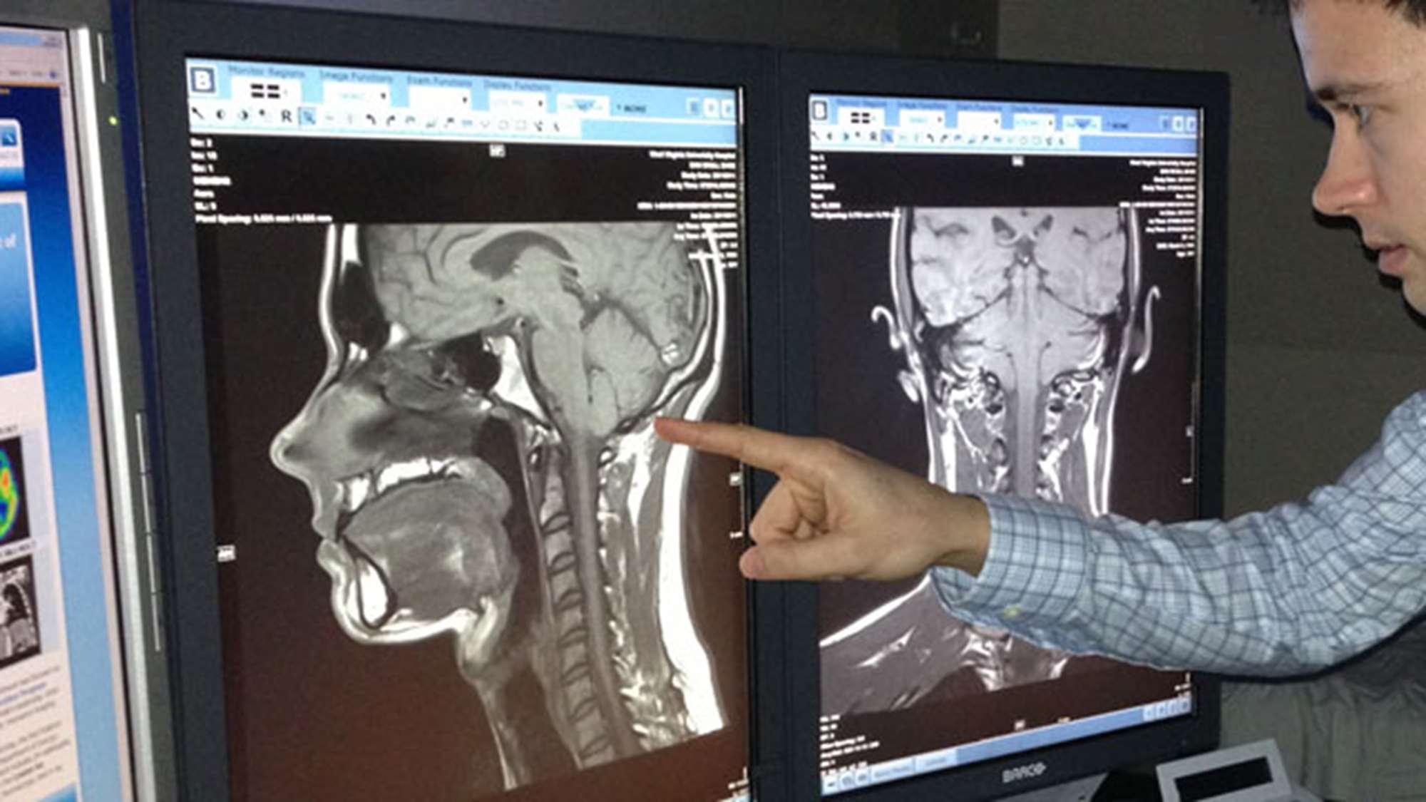 radiology school of medicine