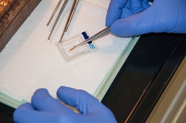 Lighmicroscopy image showing a researcher placing a specimen on a slide with a pair of tweezers.