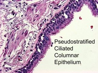 This is a section of lung, more specifically the bronchi. The respiratory tract is covered by a specialized type of ciliated epithelium. The cilia help expel foreign materials that we breath in.