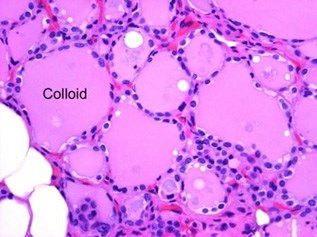 This is a section of thyroid. The thyroid follicles contain colloid, which is stored inactive thyroid hormones.